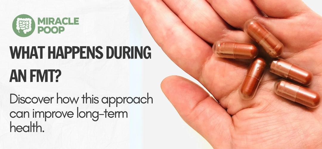 Illustration of fecal microbiota transplant procedure steps